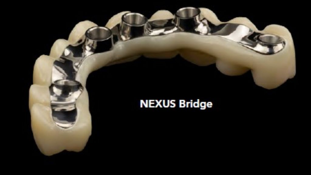 aurumtek-nexus-bridge-no-gingiva